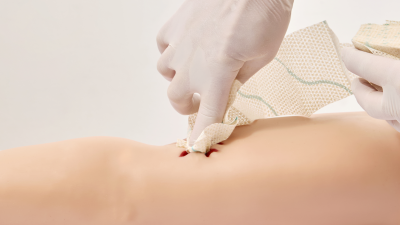 application of SPeedM onto the woundground of a modell arm